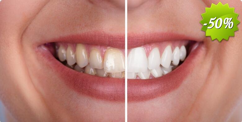 Revolucionarna tehnologija izbjeljivanja zubi Opalescence Boost do 3 nijanse svjetliji zubi uz trajnost do čak 3 godine