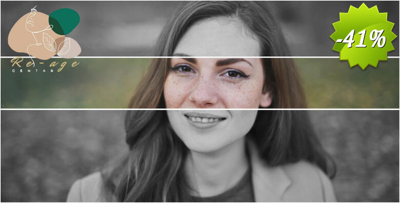 Želite se rješiti tamnih mrlja na svom licu ili rukama ili dekolteu? To više nije problem uz IPL tretman za uklanjanje HIPERPIGMENTACIJE u Re-age Centru