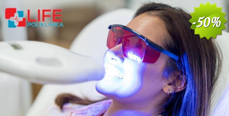 IZBJELJIVANJE ZUBI - izrada udlaga prema individualnim potrebama uz pregled i konzultacije stručnog tima Poliklinike Life i KUĆNI set za izbjeljivanje