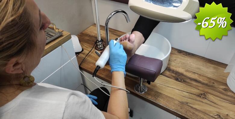 Vratite glatku kožu bez operacija - uklanjanje bradavice s ruke ili noge ozonom uz tretman biolaserom u Studiju ljepote Manuela