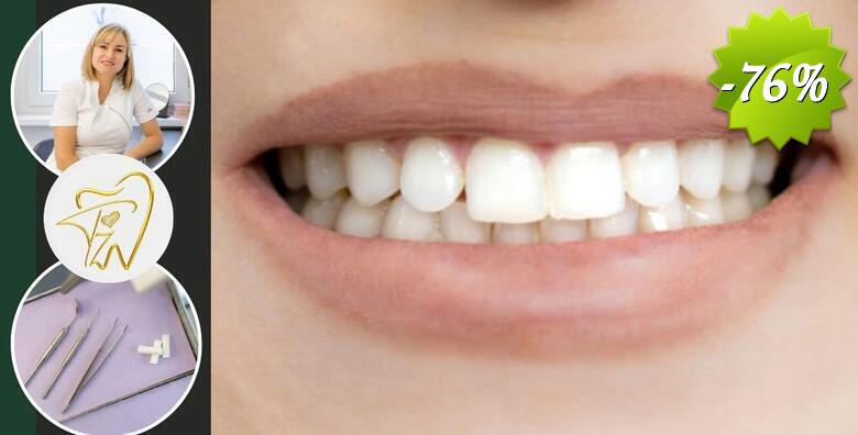 Čišćenje kamenca, pjeskarenje i fluoridacija zubi u Ordinaciji dentalne medicine Tijana Župan,dr.med.dent.