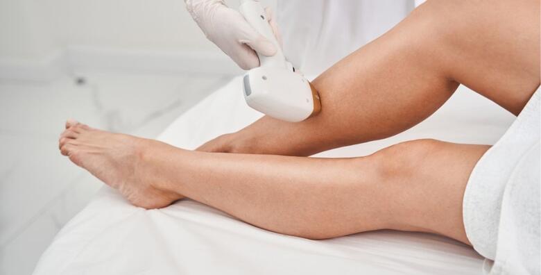IPL TRETMAN - trajno uklanjanje dlačica na odabranom području u Studiju ljepote Manuela