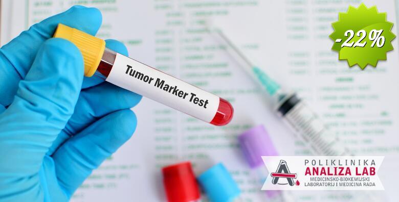 Tumorski marker za žene ili muškarce u Poliklinici Analiza Lab - bez najave i uz nalaze gotove isti dan