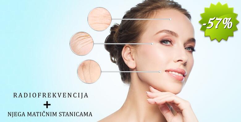 RADIOFREKVENCIJA + NJEGA MATIČNIM STANICAMA - 90 minuta potpuno bezbolnog tretmana u Jean d`Arcel Medical & Beauty Institutu