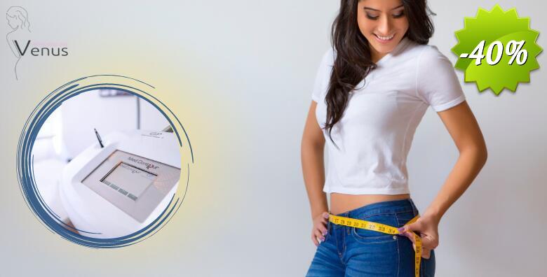 Med Contour aparat za mršavljenje u Medicinsko estetskom centru Venus by Lucija Šarić - do 2,5 cm manje odmah nakon tretmana, EKSKLUZIVNA ponuda!