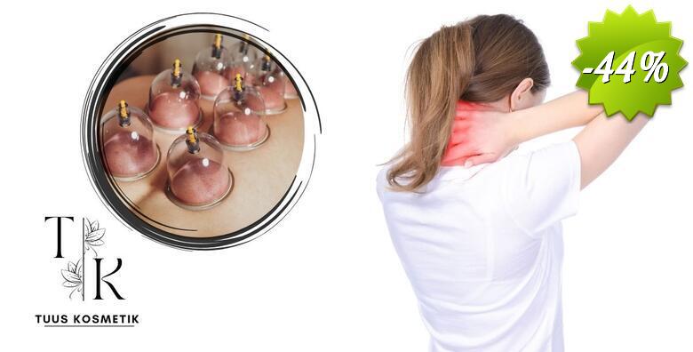 CUPPING MASAŽA u Tuus Kosmetik - napravite detox ili tretirajte bolne mišiće, glavobolje i probleme s kralježnicom