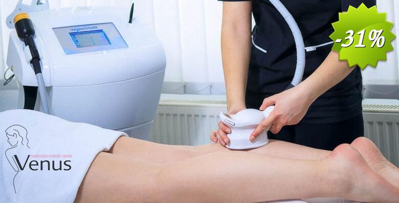 MED2CONTOUR u Medicinsko estetskom centru Venus u SESVETAMA - najbolji svjetski tretman oblikovanja tijela i nekirurškog uklanjanja masnih naslaga
