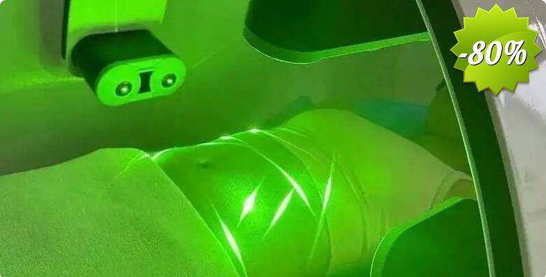REVOLUCIJA MRŠAVLJENJA - 4 tretmana Green Cold Laserom i GRATIS 2 limfne drenaže