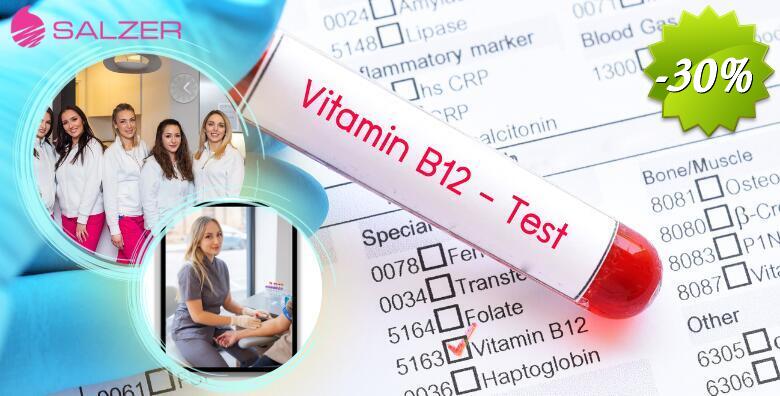 LABORATORIJSKE PRETRAGE VITAMINA I MINERALA IZ KRVI u Poliklinici Salzer u Zagrebu i Velikoj Gorici