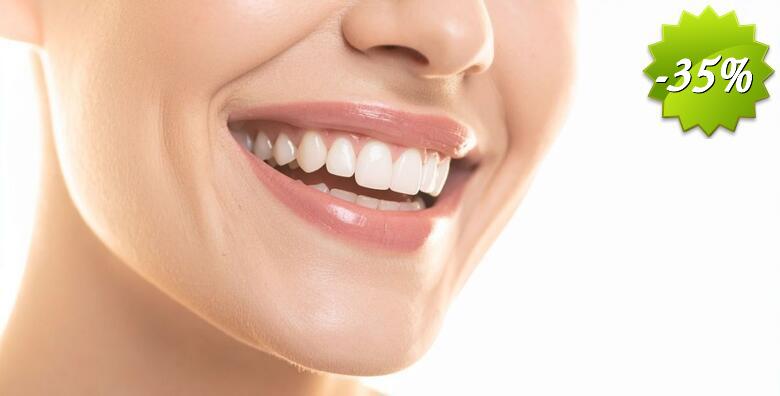 Stomatološka ordinacija Kokić Borić Karolina - izbjeljivanje zubi Boost gelom uz čišćenje kamenca, poliranje, pjeskarenje i premazivanje Tooth Mousse pastom