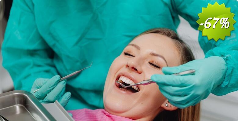 Čišćenje kamenca, pjeskarenje, poliranje i pregled zubi u Ordinacija dentalne medicine Kalauz - Devčić