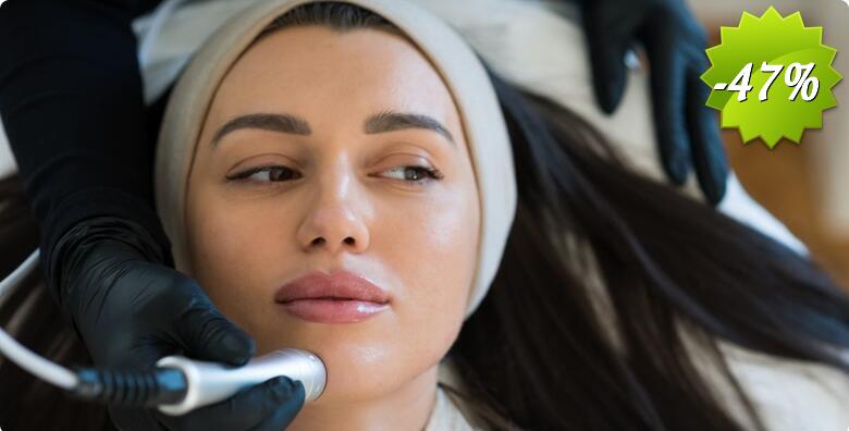 HydraFacial tretman koji uklanja nečistoću i masnoće u Studiju ljepote Manuela