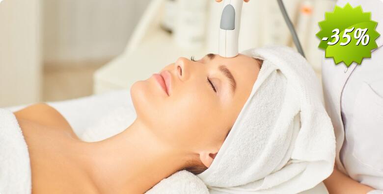 DERMAPEN revitalizacija kože – 1 tretman u studiju za ljepotu Aura Bliss