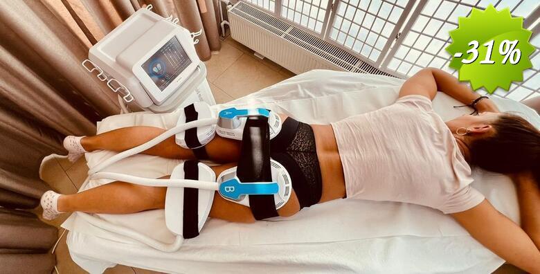 Oblikujte i zategnite tijelo uz Tesla tretmane + RF tehnologiju u Alma beauty centru