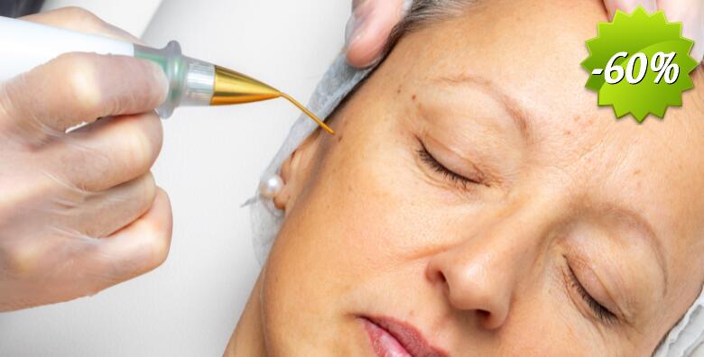 Uklanjanje bradavice, keratoze ili fibroma inovativnim tretmanom PLASMA PEN u Bio+klinik kozmetičkom salonu