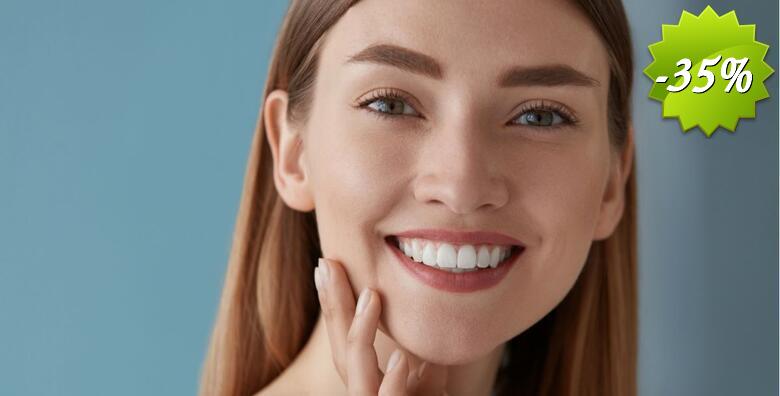 4 kompozitne ili keramičke krunice uz koje ćete ispraviti oblik, boju, veličinu ili položaj zuba u ordinaciji Dentique Dental Ofifice