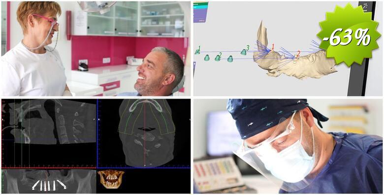 CBCT 3D snimka kompletne gornje i donje čeljusti uz detaljnu analizu snimke, besplatan dentalni pregled i konzultacije