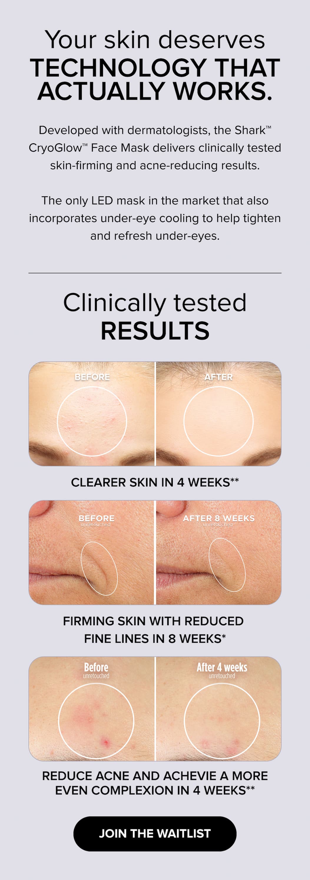 Your skin deserves technology that actually works. Developed with dermatologists, Shark CryoGlow LED mask delivers clinically tested skin-firming and acne-reducing results. The only LED mask with under-eye cooling to tighten and refresh. Clearer skin in 4 weeks, firmer skin with reduced fine lines in 8 weeks. JOIN THE WAITLIST.