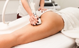 S��ances de remodelage corporel VelaShape��