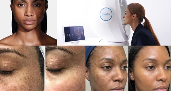 BioLED, Jet Peel, Hydra Boost, Meso Boost, anti-âge ou autre : diagnostic ou soin visage au choix - de 30 à 60 min.