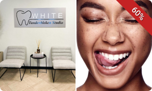 Tandenbleekbehandeling naar keuze