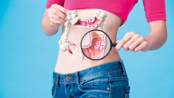 zelfstests darmkanker