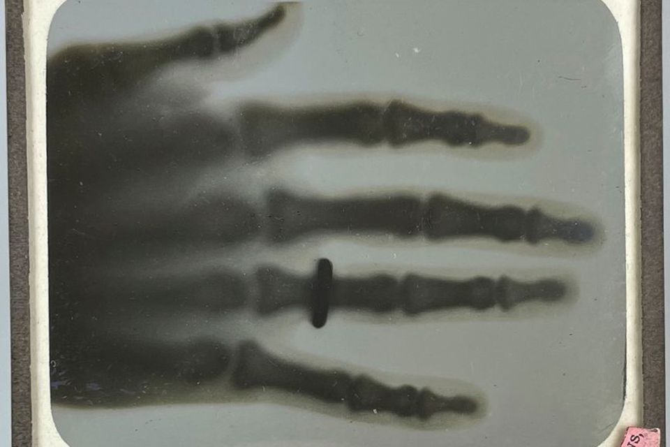 One of the earliest X-Rays
