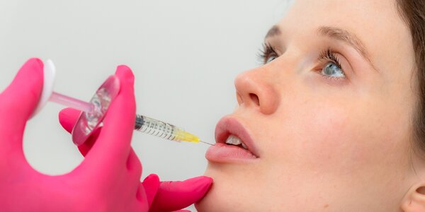 „Russian lips“, hydratácia alebo modelácia pier kys. hyalurónovou